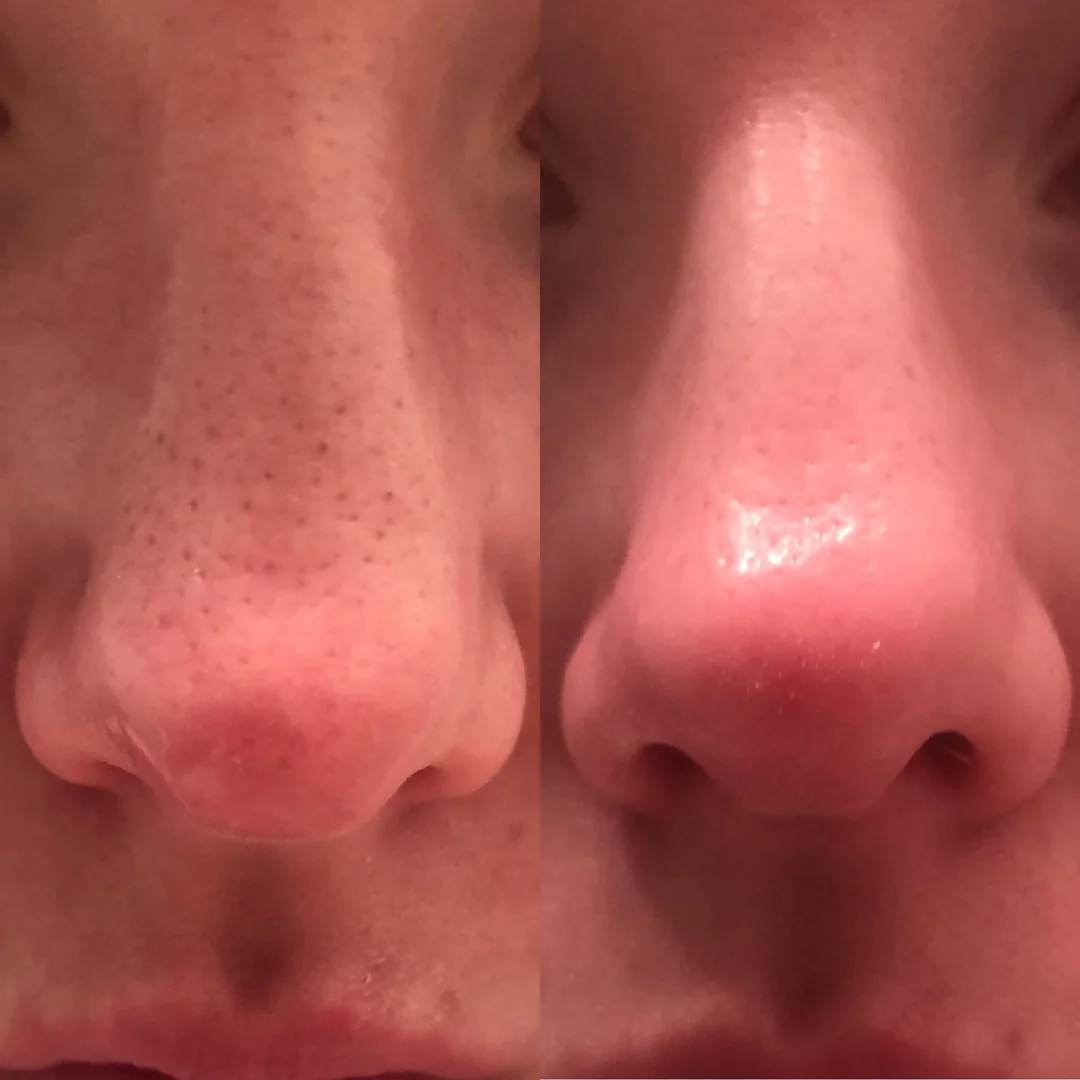 Rice Peel Shot Exfoliator