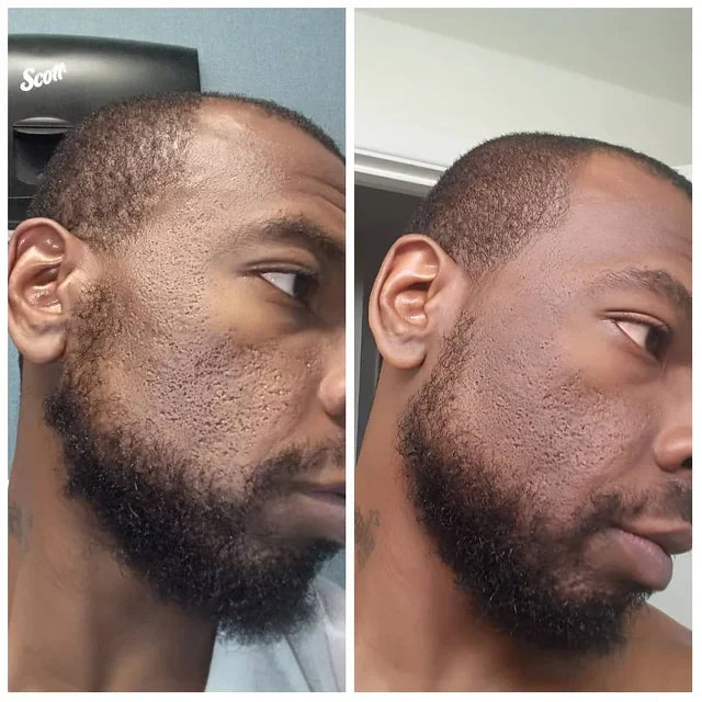 Rice Peel Shot Exfoliator