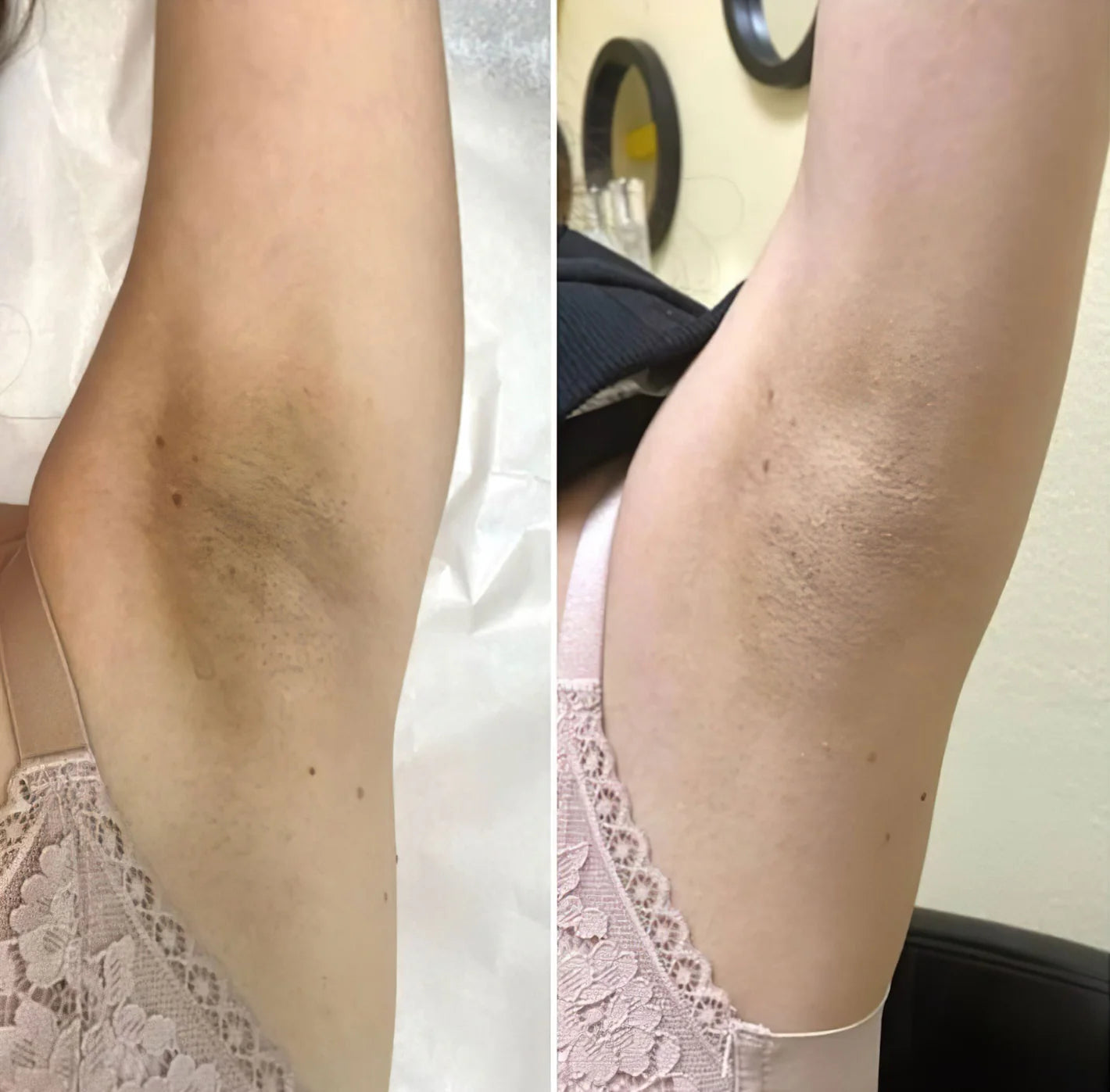 Rice Peel Shot Exfoliator